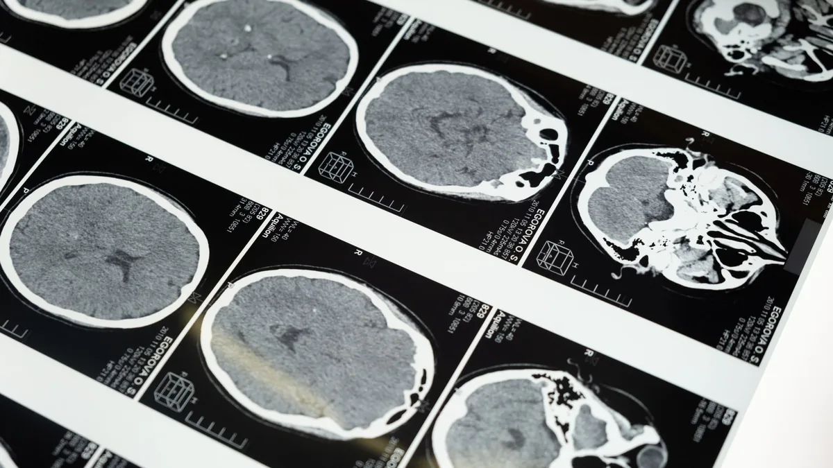 Your CT Scan Is Clear and Your Head Still Isn’t. Here’s What That Actually Means.